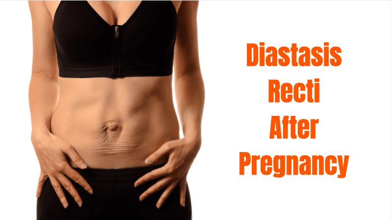 Diastasis Recti During Pregnancy – Pregnancy and Postpartum PT