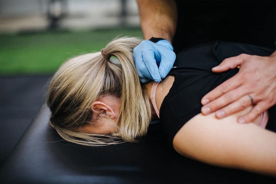 Dry Needling | Onward Physical Therapy