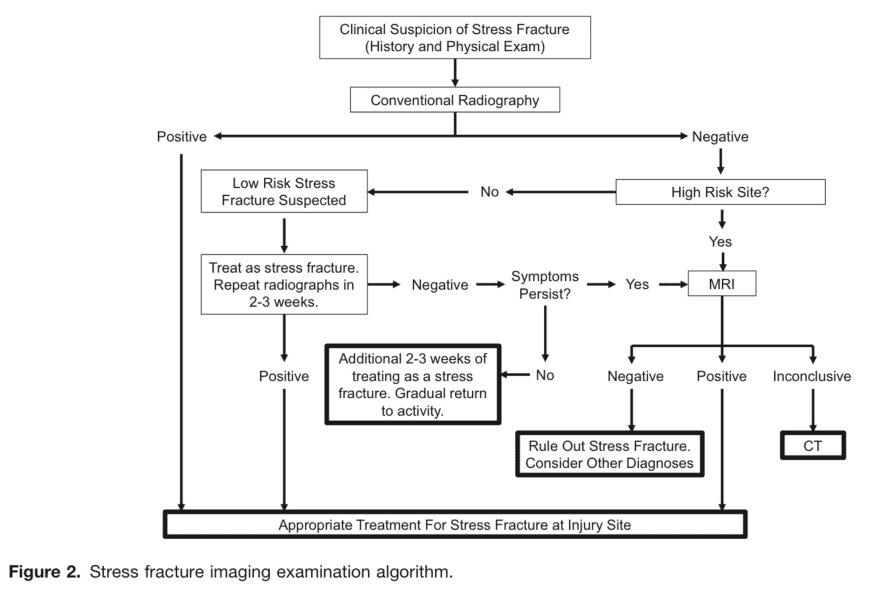 Bone stress injury algorithm