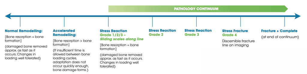 running with a stress fracture continuum