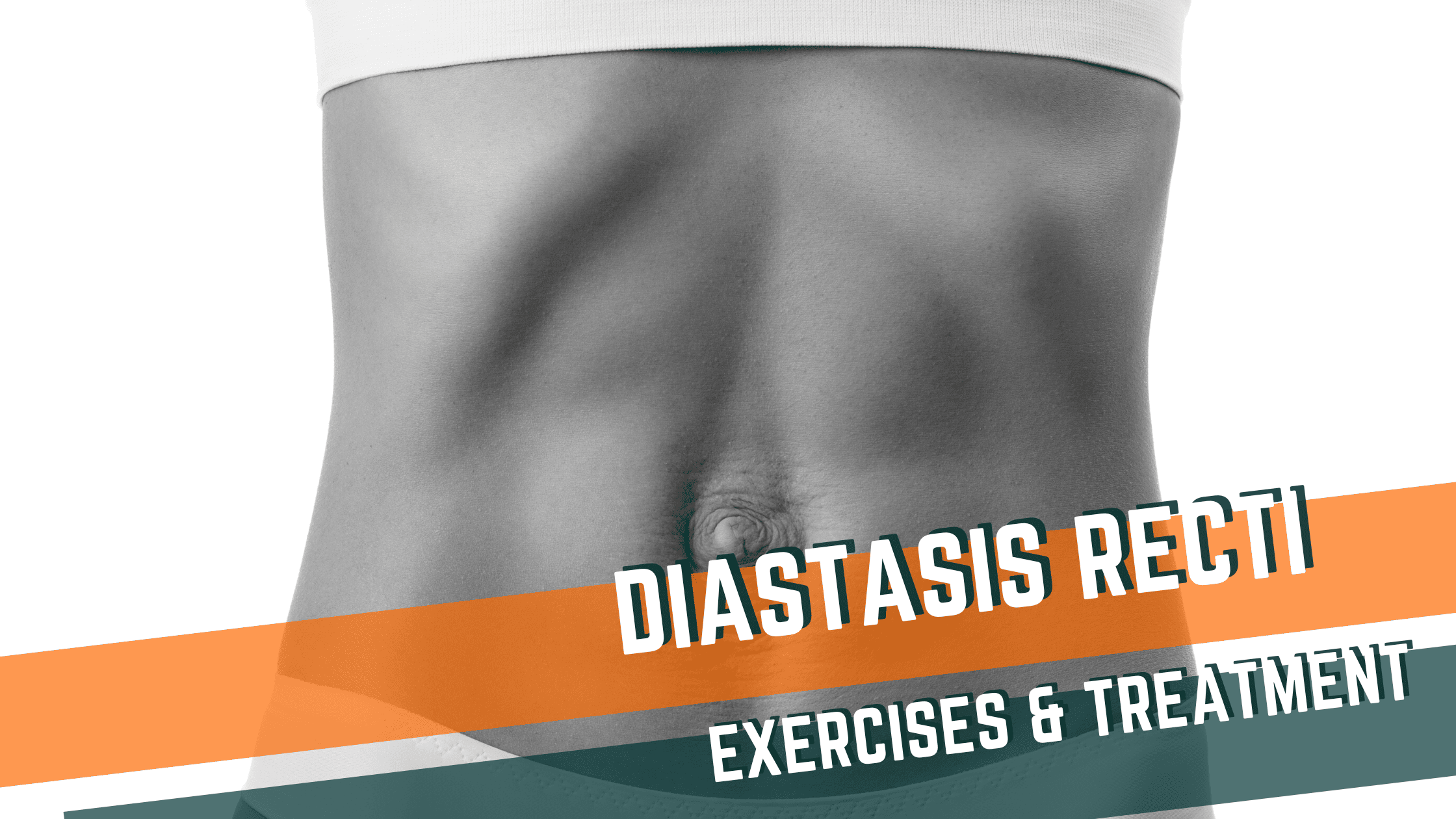 Featured image for “Diastasis Recti? A sign you need to get stronger.”