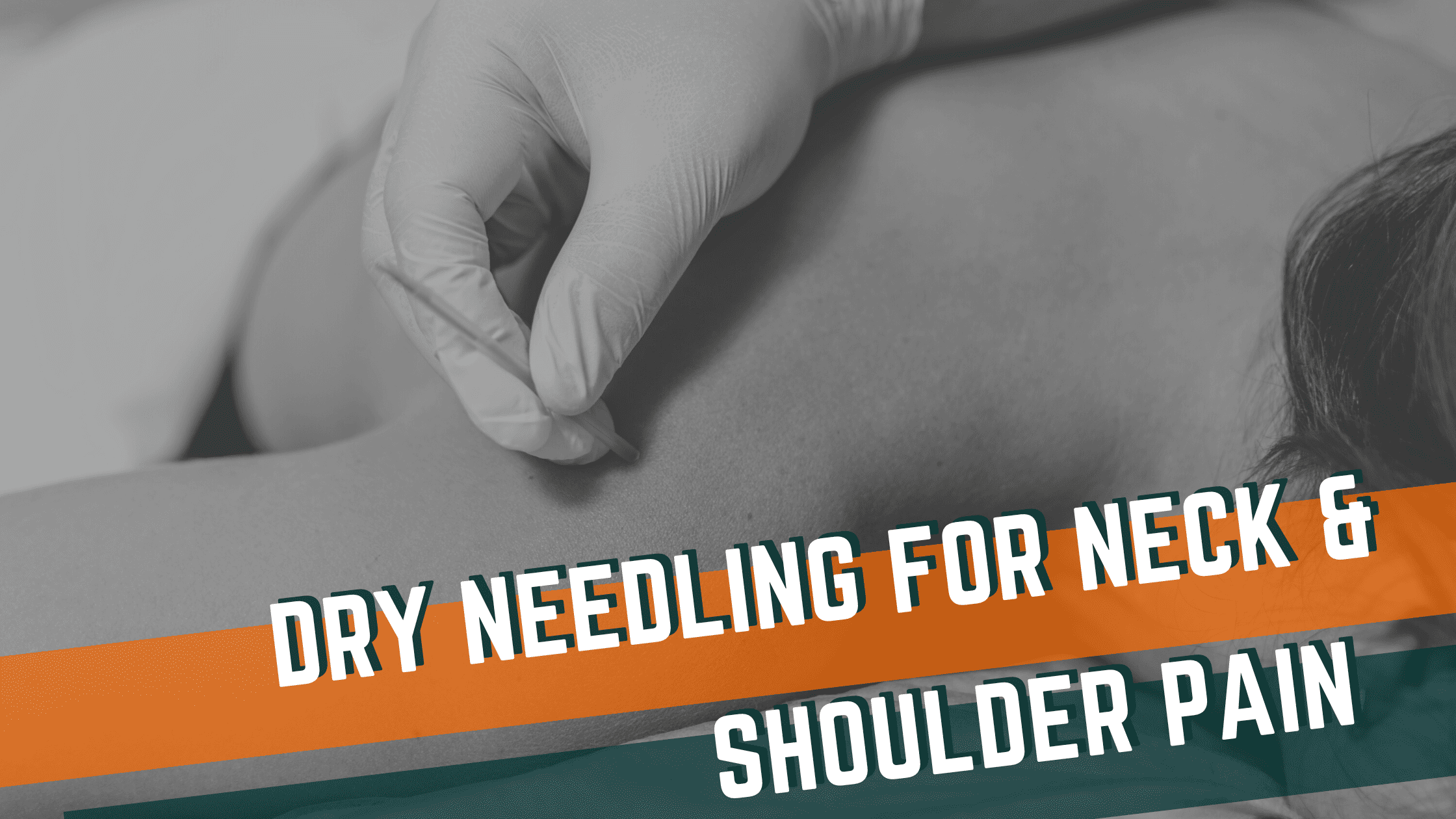 Dry Needling for Neck & Shoulder Pain