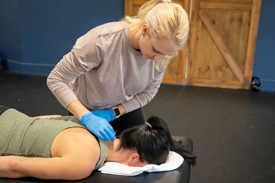 Dry Needling | Onward Physical Therapy