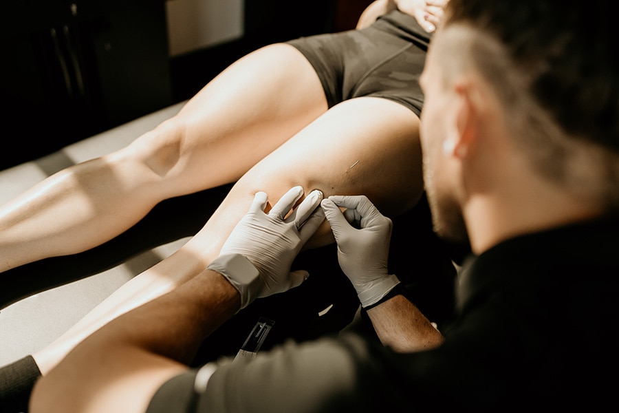 Dry Needling | Onward Physical Therapy