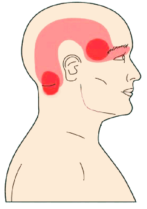 Featured image for “Effective Physical Therapy Exercises for Relieving and Preventing Headaches”