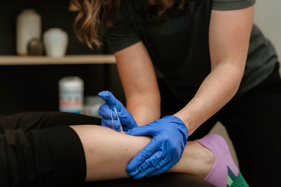 Dry Needling | Onward Physical Therapy