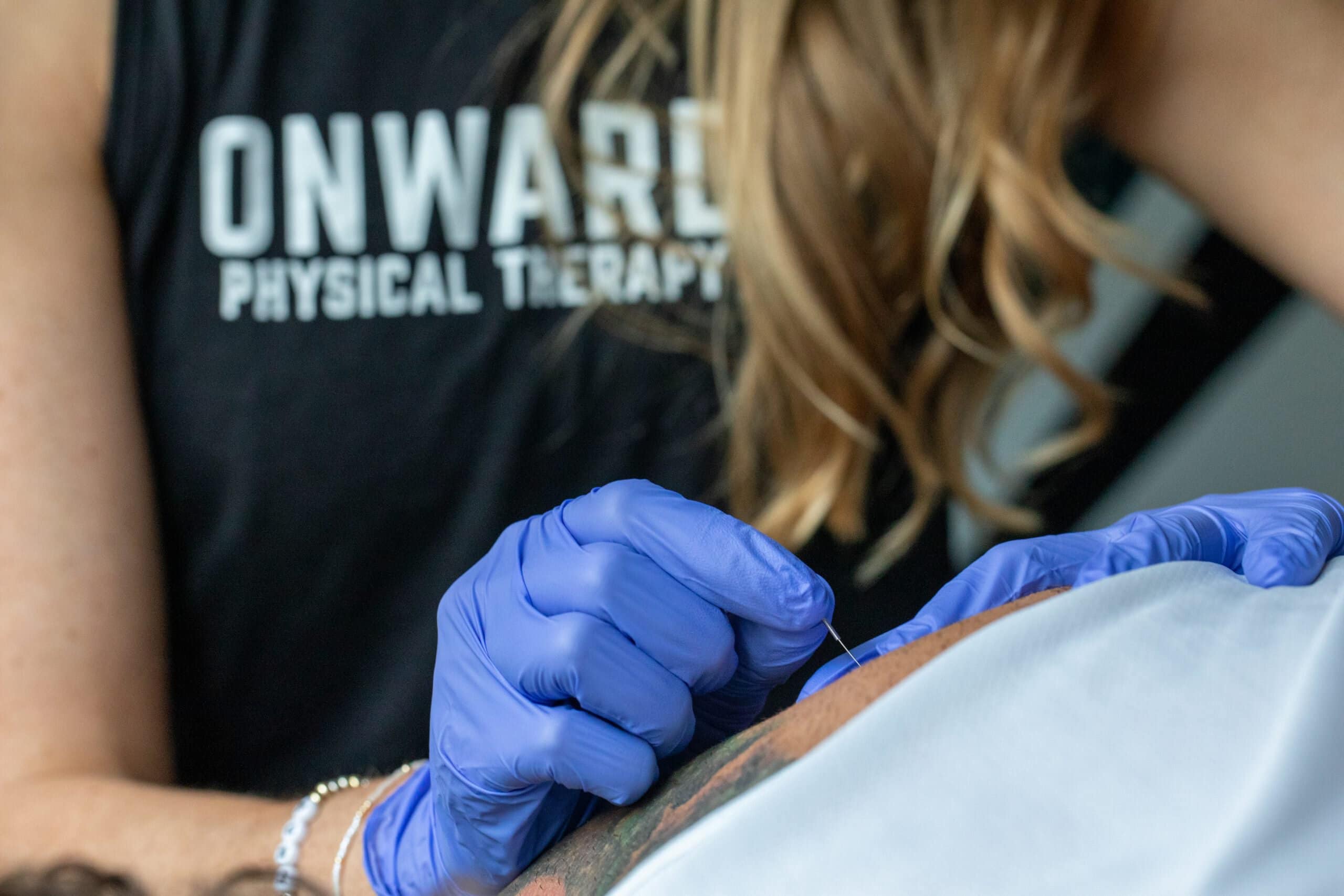 Dry Needling | Onward Physical Therapy