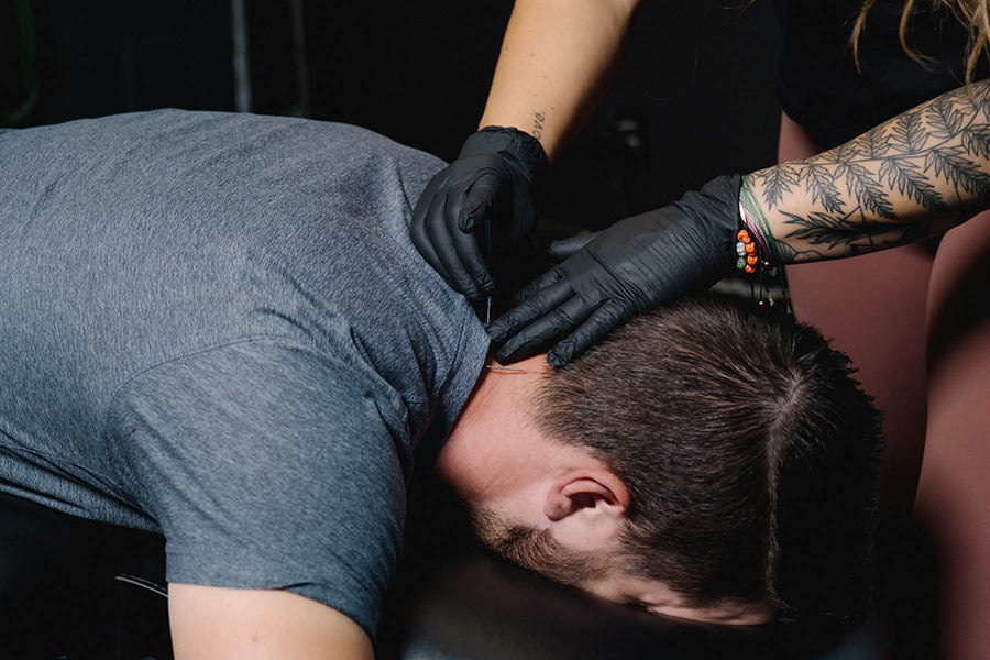 Dry Needling | Onward Physical Therapy