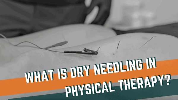 Featured image for “What is Dry Needling in Physical Therapy?”